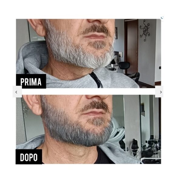 CERA NERA MR Y prima dopo